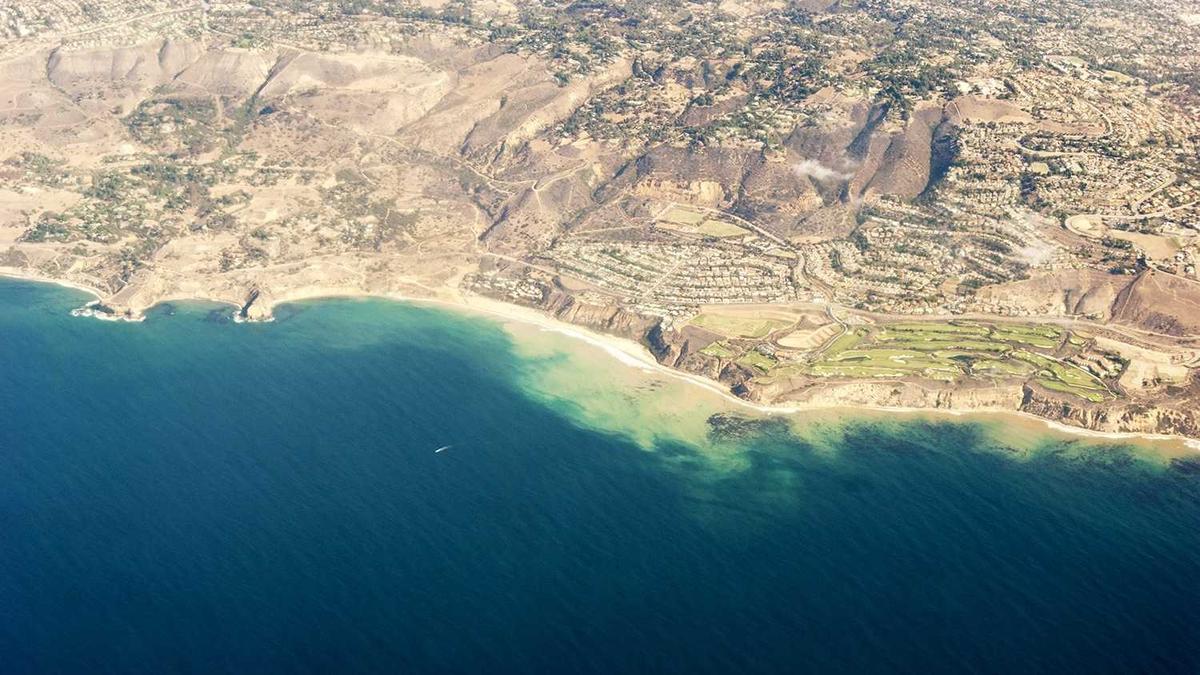 用按摩器棒能减肚子吗